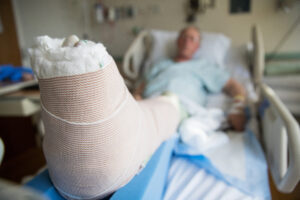 person with a cast on their broken leg